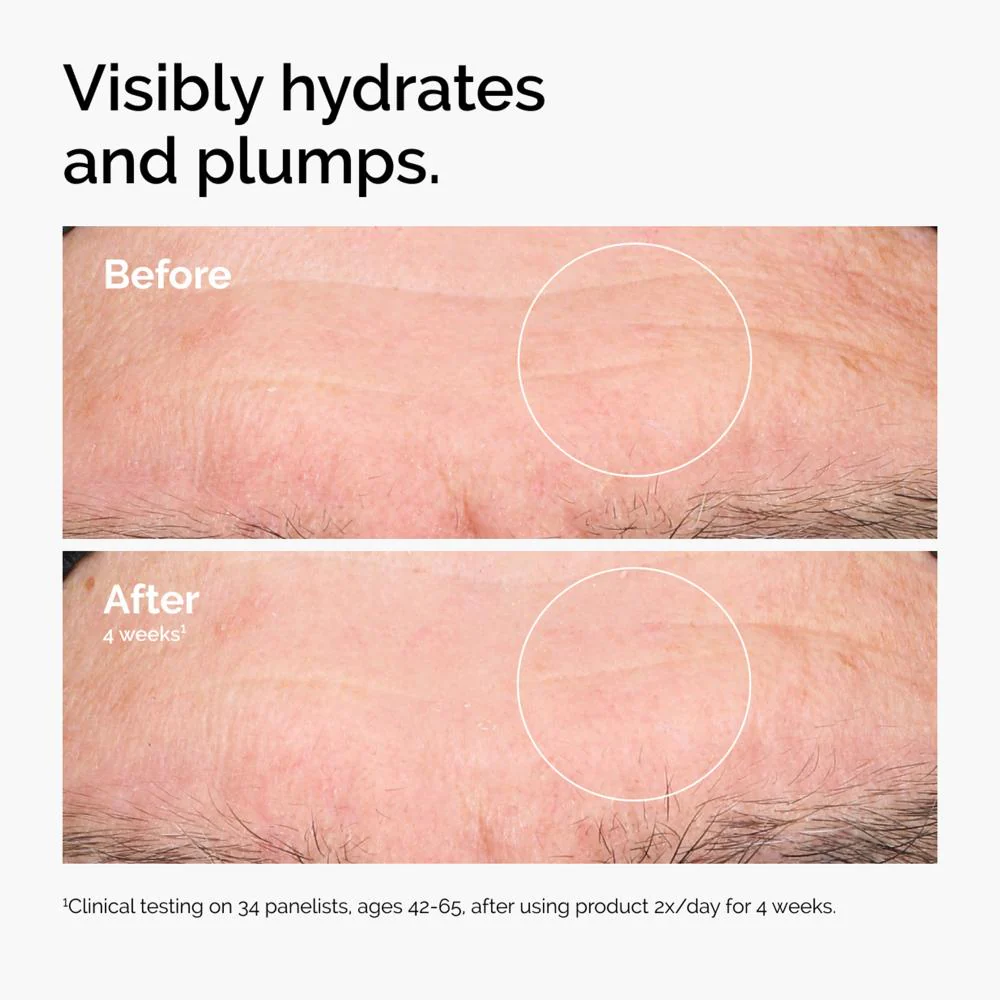 The Ordinary Hyaluronic Acid 2% + B5 V2 30ml - Image 18