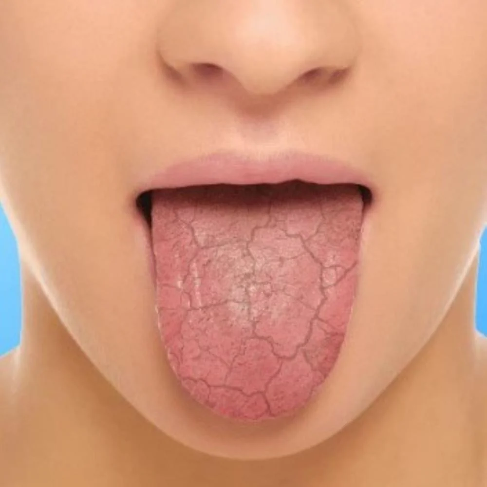 Xerostom Mouth Spray 15ml - Image 3